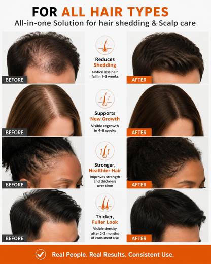 Korea's #1 Hair Growth Serum